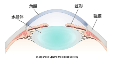 眼内のレンズ（水晶体）